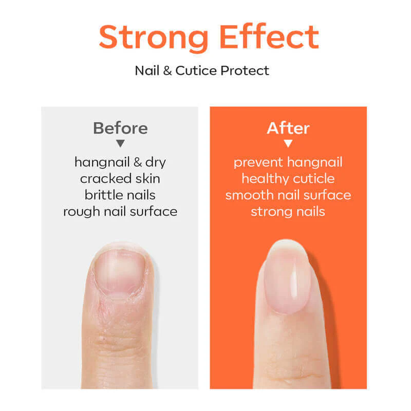 Cuticle Oil with Top & Base Coat Set - Image 2