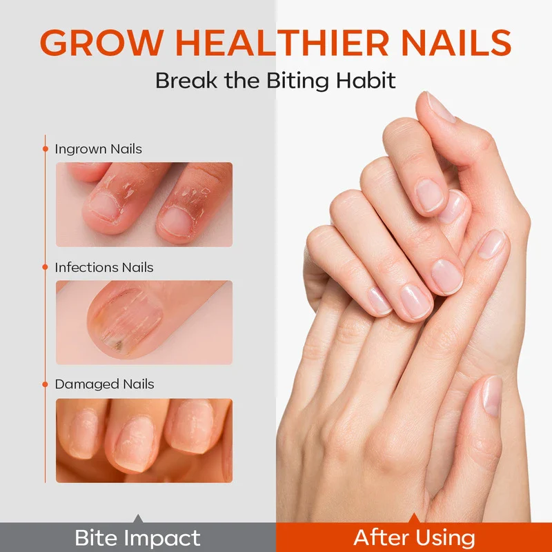 Stop Biting Polish - Image 2