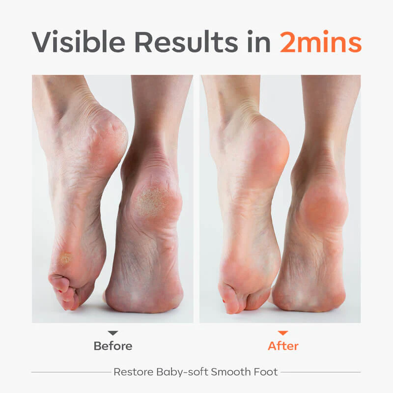 Super Nano Glass Foot File - Image 7